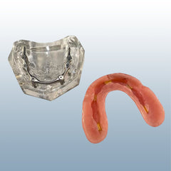 Hader Bar Six Implants Model Overdenture