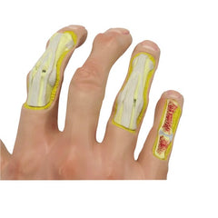 Hand With Osteoarthritis Model