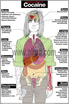 Harmful Effects of Cocaine Poster 