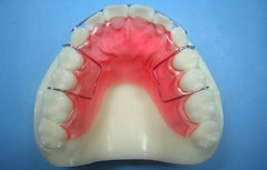 Standard Hawley Retainer Orthodontic Model