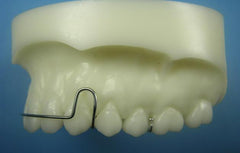 Standard Hawley Retainer Orthodontic Model