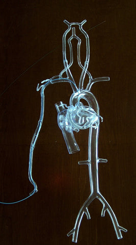 heart catheterization model