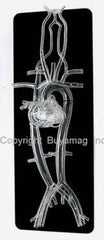 heart catheterization stent balloon simulator model