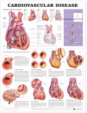 Heart Cardiovascular Disease Poster Chart