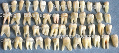 human molar teeth for sale