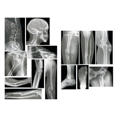 human x-ray pictures film images
