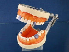 Hygiene Periodontal Model calibration caries detection