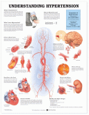 Hypertension Understanding Poster
