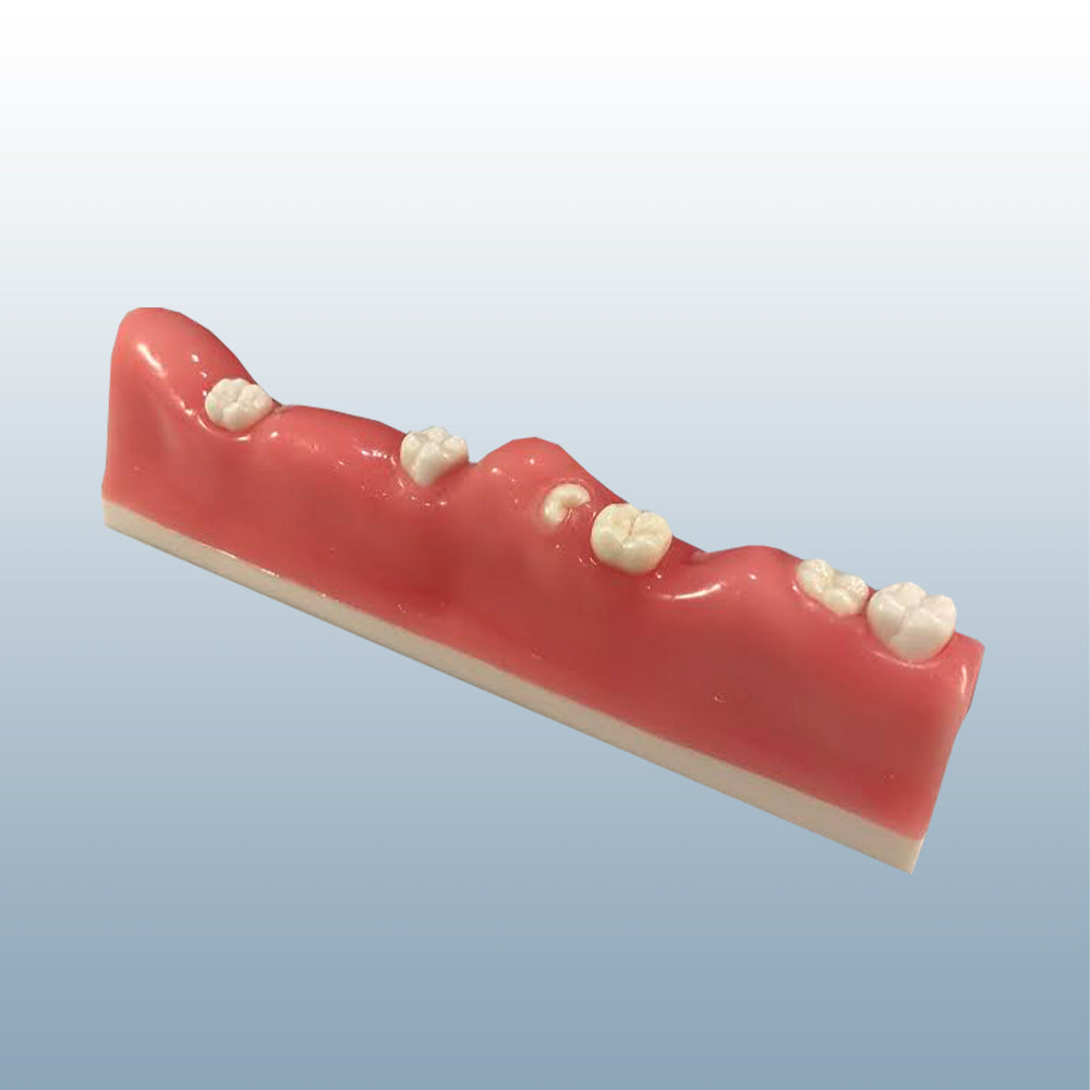 Impacted Eruption Tooth Extraction Model - Suture Buyamag – Buyamag INC