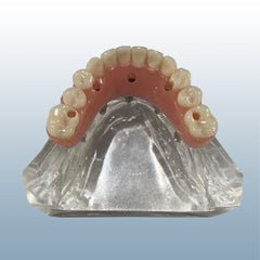 implant dental model