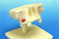 Sinus Lift Maxillary Model