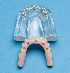 Implants H/W Bridge 14 Units