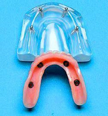 Implants Combo 2 parts