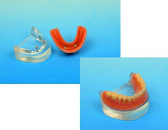 dental implant model