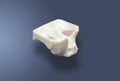 Sinus Lift Maxillary Model