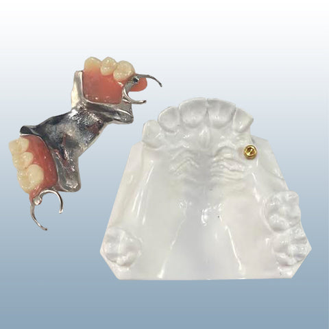 Implant Overdenture Partial framework thermoflex model