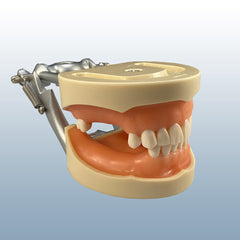 impressions take dental model