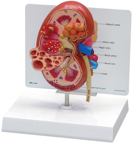Kidney Model Normal & Pathology