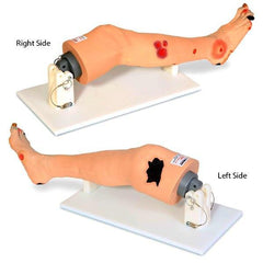 diabetic neuropathy foot wounds model