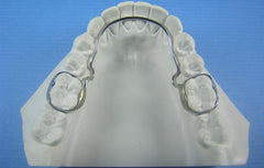 Loops Retainer orthodontic model