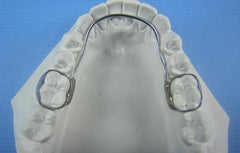  Loops Retainer Orthodontic Model