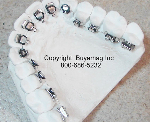 Lingual Brackets Orthodontic Appliance Model 