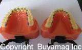 Lingual Orthodontic Model With Lingual Brackets