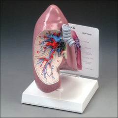 lung model