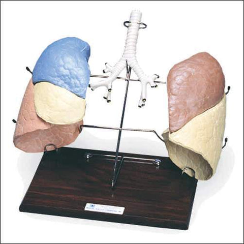  lungs Larynx bronchi tree Model