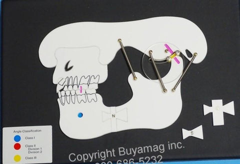 Teeth Malocclusion Model board