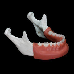 mandible implant drilling model