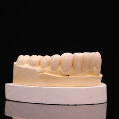 Dental teeth veneer model