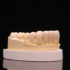 Dental teeth veneer model