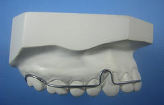ARC Comfort Retainer Orthodontic Model