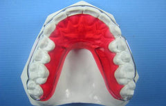 ARC Comfort Retainer Orthodontic Education Model