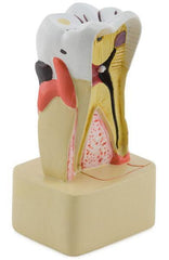 Molar tooth pathological model