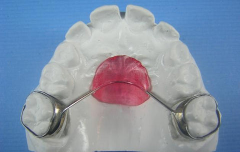 nance retainer orthodontic model