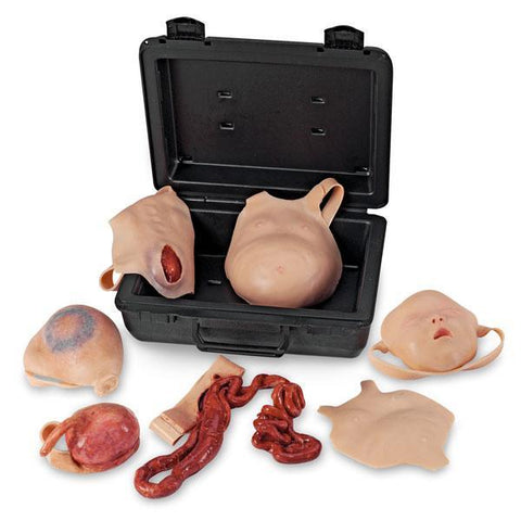 Newborn Wound Model Kit