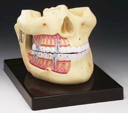 Deluxe Upper & Lower Jaw Model