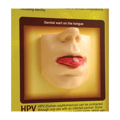 oral sex potential dangers diseases display model