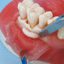 oral surgery model