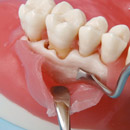 dental oral surgery model