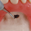 dental oprative model