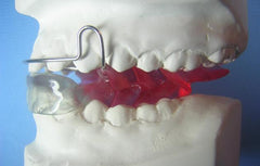 bionator Orthodontic appliance model