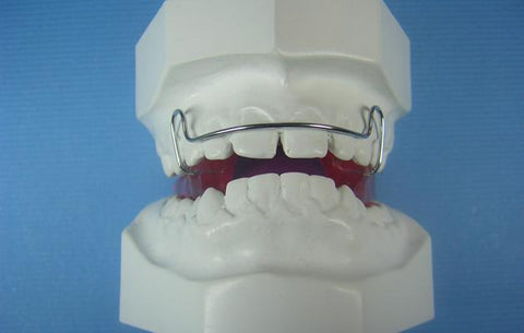 Bionator Close Orthodontic Appliance Model