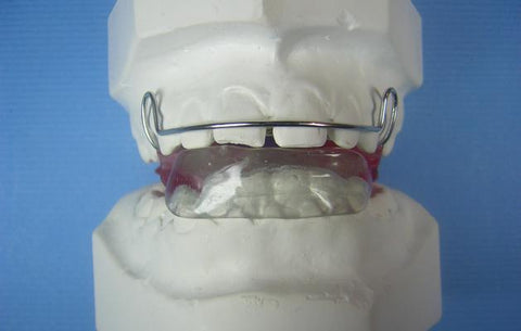 bionator Orthodontic appliance