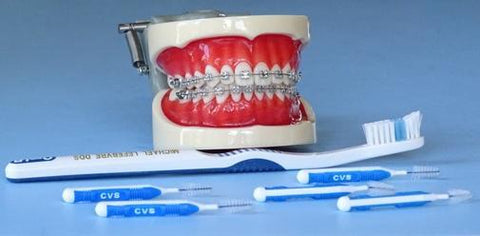 Orthodontic Model Tooth Brushing & Braces Wire