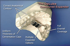 palatal Expander Orthodontic retainer Model 