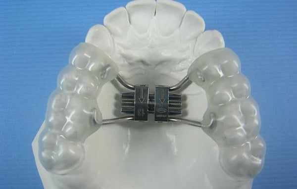 Contoured Expander Orthodontic Model 
