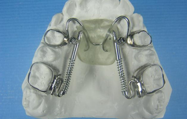 Distal Jet distalizer orthodontic model appliance retainer
